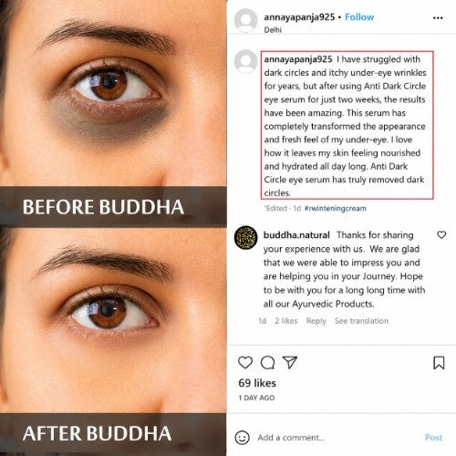 Anti Dark Circle Eye Serum - 100% Ayush Certified - Helps to Reduce Dark Circles, Puffiness Around Eyes - Enriched with Vitamin C