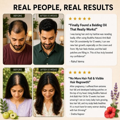 Anti Bald Hair Oil - 100% Ayush Certified - Fights Baldness, Promotes Hair Growth, Revitalizes Root Follicles & Reduces Hair Loss