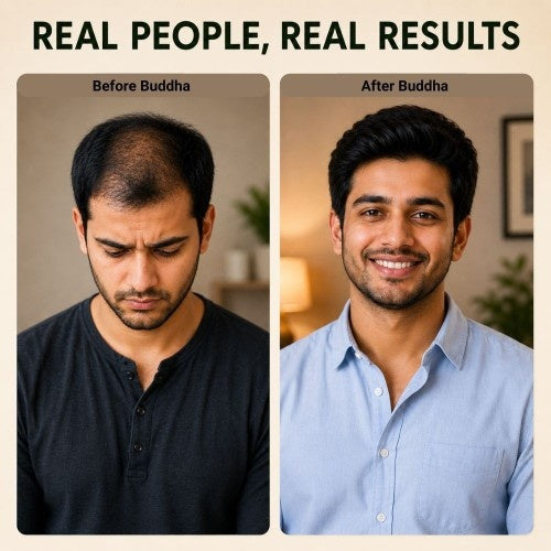 Anti Bald Hair Oil - 100% Ayush Certified - Fights Baldness, Promotes Hair Growth, Revitalizes Root Follicles & Reduces Hair Loss